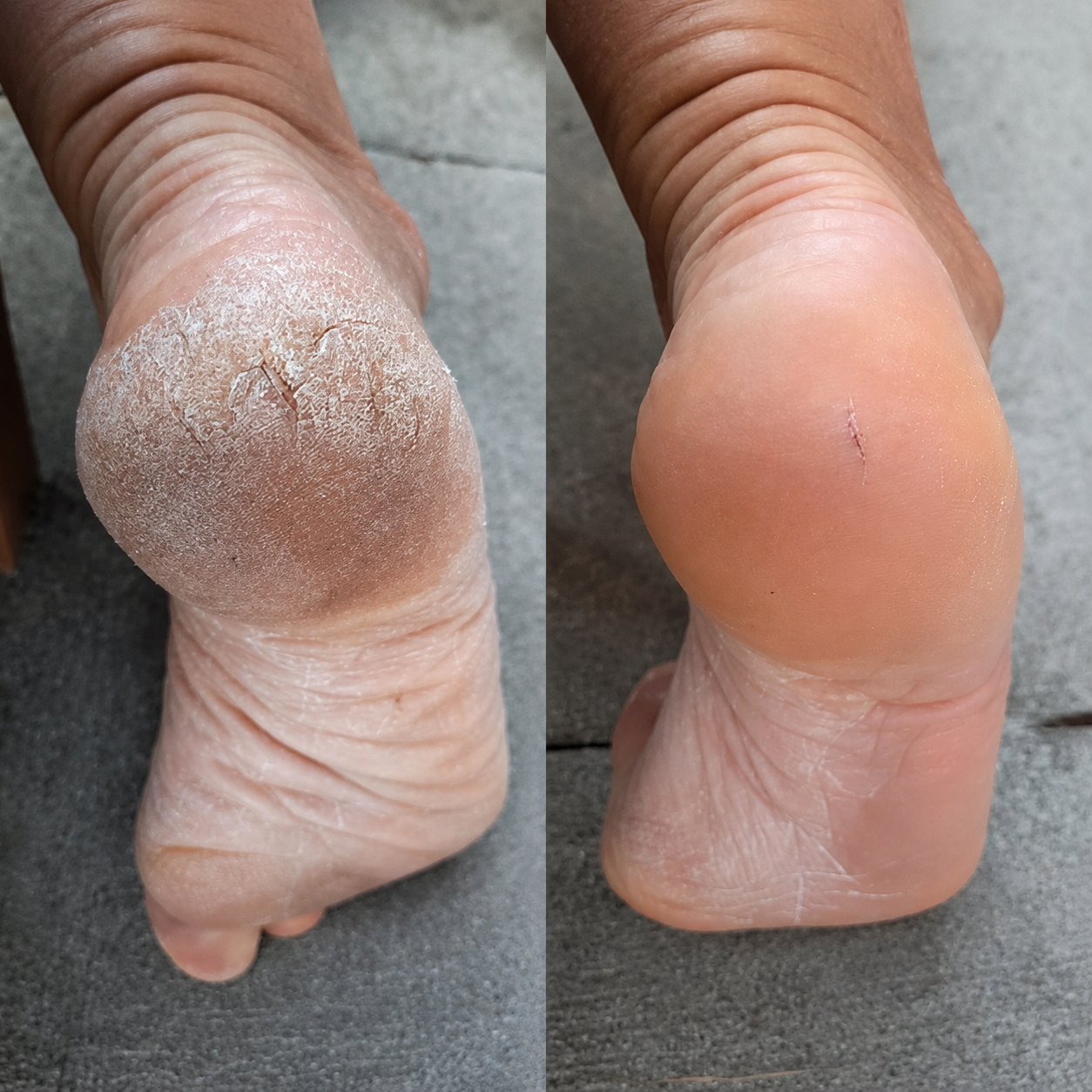 Customer result comparison