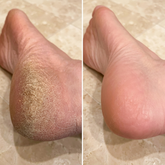 Customer result comparison