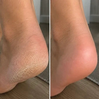 Customer result comparison